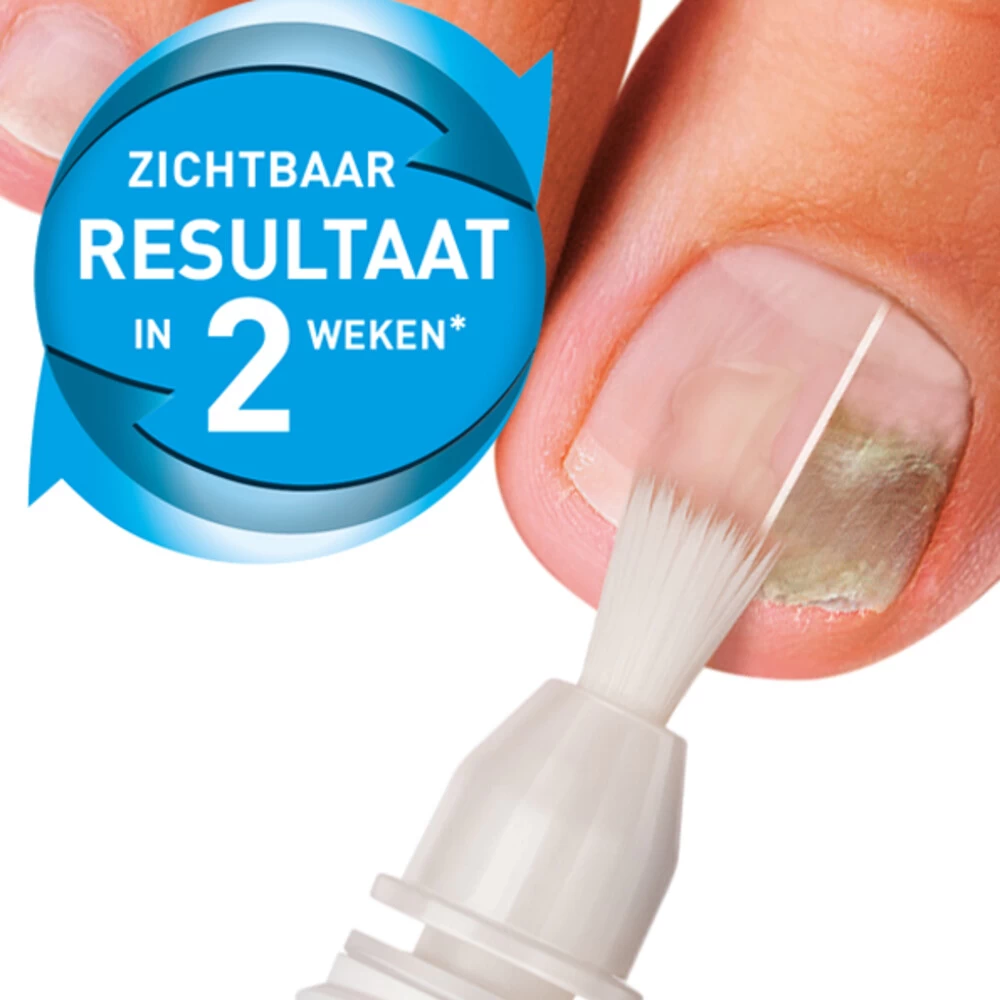 Mycosan Kalknagel Met Voet En Schoenpoeder Pakket - Afbeelding 2